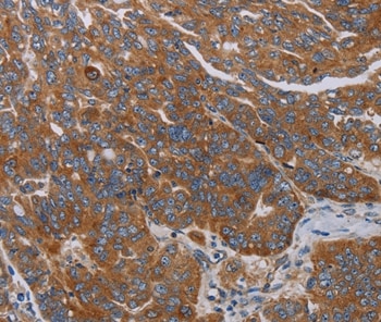 PARP10 Antibody in Immunohistochemistry (Paraffin) (IHC (P))