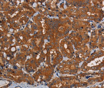 PDE5 Antibody in Immunohistochemistry (Paraffin) (IHC (P))