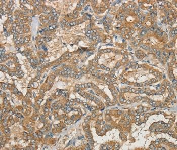 CWC27 Antibody in Immunohistochemistry (Paraffin) (IHC (P))