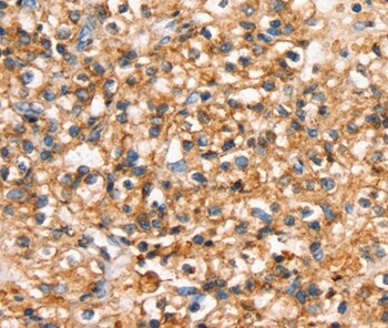 SLC34A3 Antibody in Immunohistochemistry (Paraffin) (IHC (P))