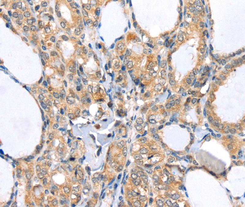 LLGL2 Antibody in Immunohistochemistry (Paraffin) (IHC (P))