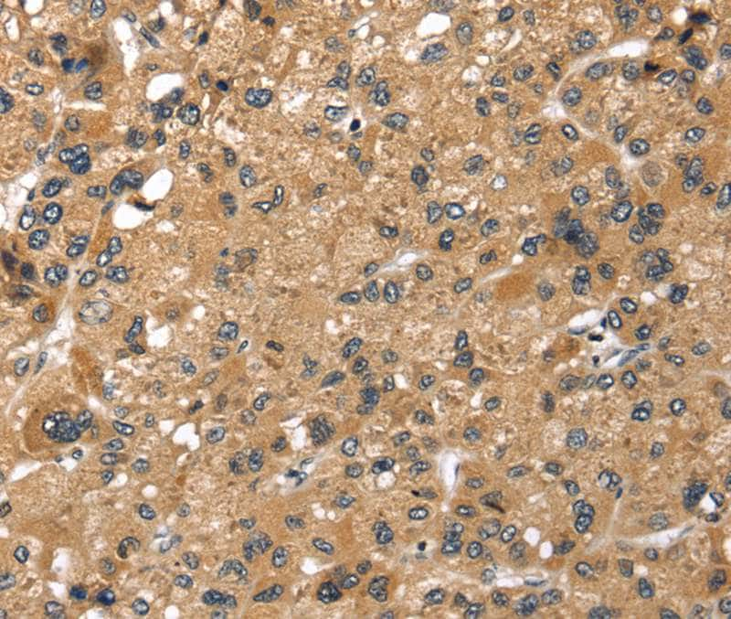 LONP1 Antibody in Immunohistochemistry (Paraffin) (IHC (P))