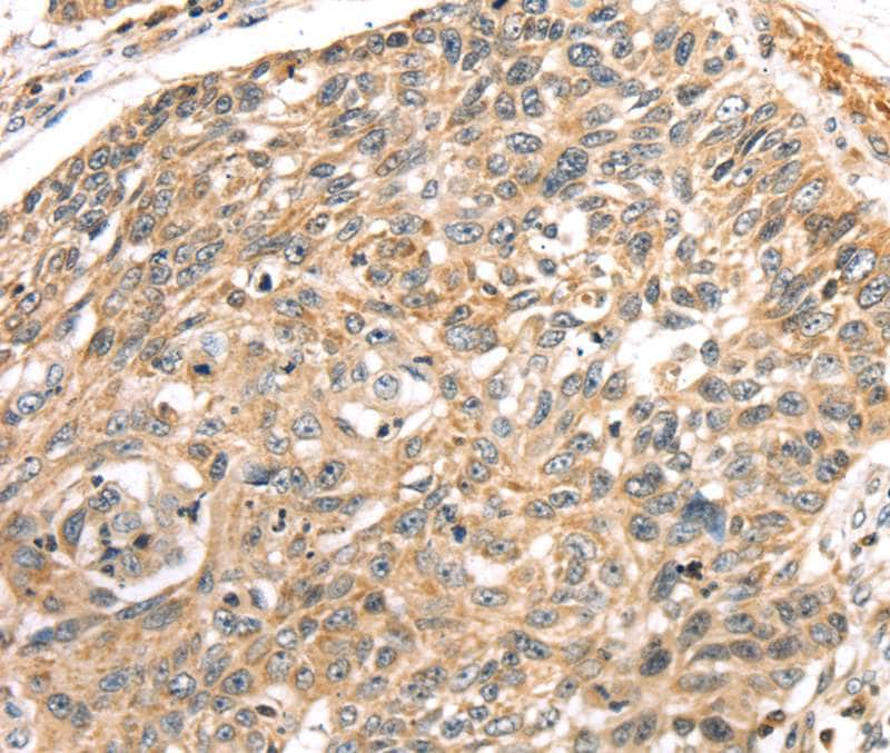 LONP1 Antibody in Immunohistochemistry (Paraffin) (IHC (P))