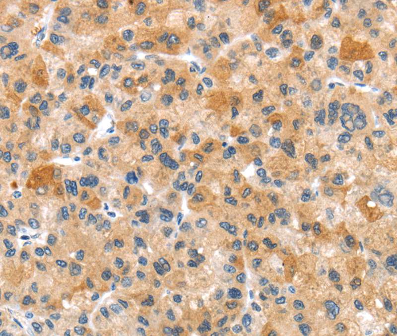 RHCG Antibody in Immunohistochemistry (Paraffin) (IHC (P))