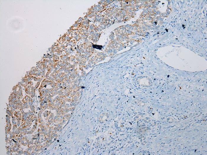 SLC6A19 Antibody in Immunohistochemistry (Paraffin) (IHC (P))