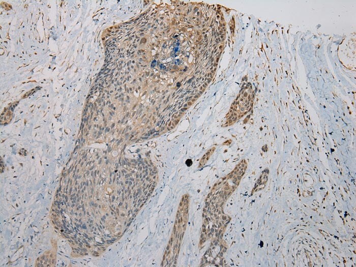 VPS36 Antibody in Immunohistochemistry (Paraffin) (IHC (P))