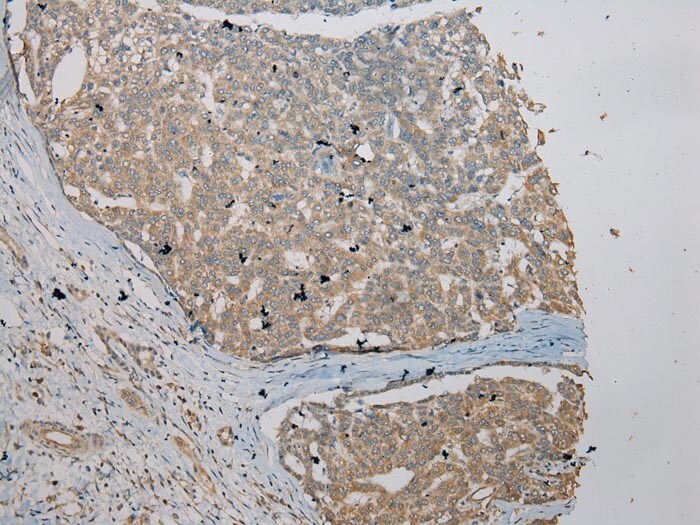 VPS36 Antibody in Immunohistochemistry (Paraffin) (IHC (P))