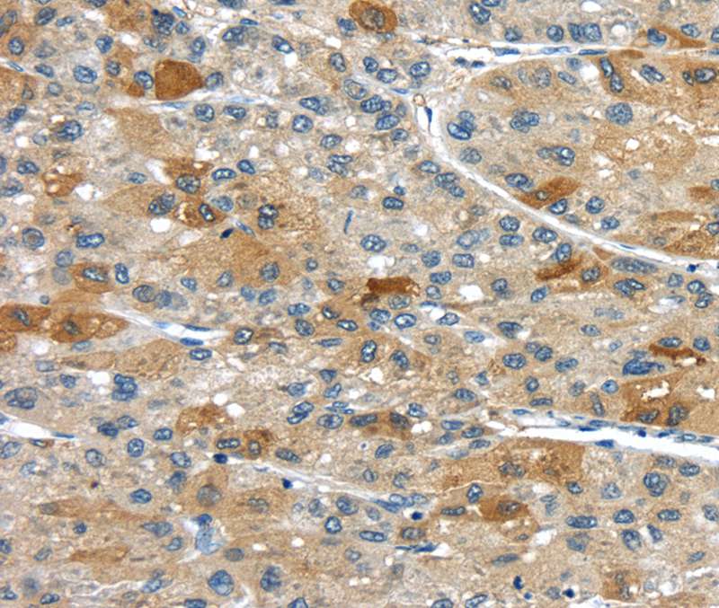 UPP2 Antibody in Immunohistochemistry (Paraffin) (IHC (P))