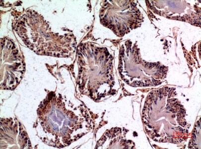 NTE Antibody in Immunohistochemistry (Paraffin) (IHC (P))