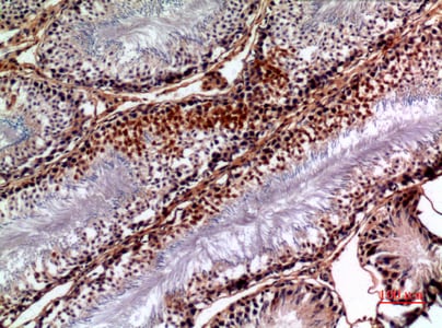 NTE Antibody in Immunohistochemistry (Paraffin) (IHC (P))