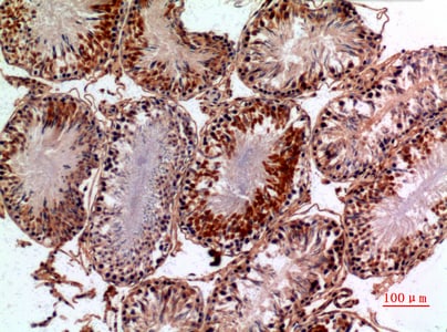 NTE Antibody in Immunohistochemistry (Paraffin) (IHC (P))