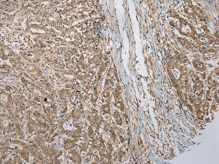 TBCA Antibody in Immunohistochemistry (Paraffin) (IHC (P))