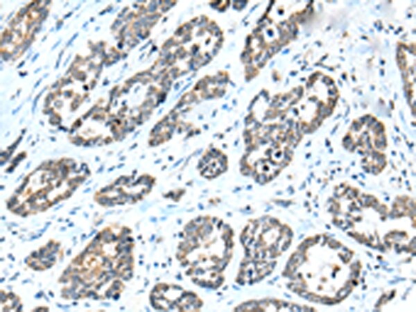 NPL Antibody in Immunohistochemistry (Paraffin) (IHC (P))