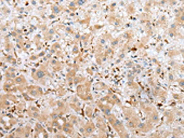 NPL Antibody in Immunohistochemistry (Paraffin) (IHC (P))