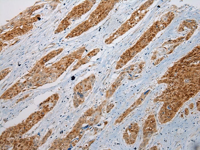 GSTM4 Antibody in Immunohistochemistry (Paraffin) (IHC (P))