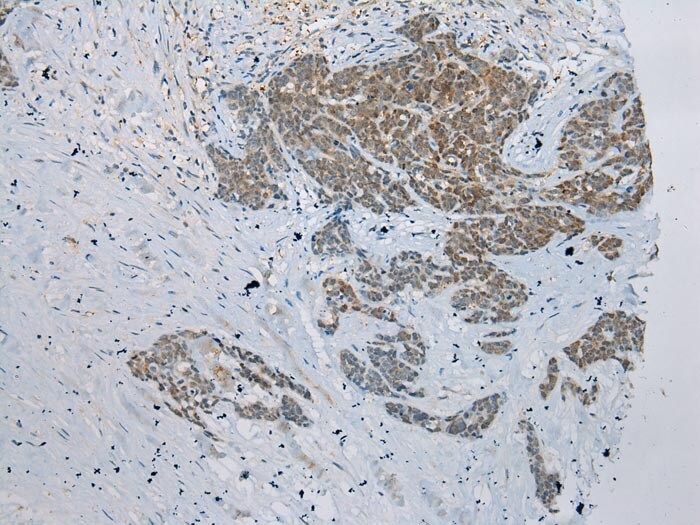 GSTM4 Antibody in Immunohistochemistry (Paraffin) (IHC (P))