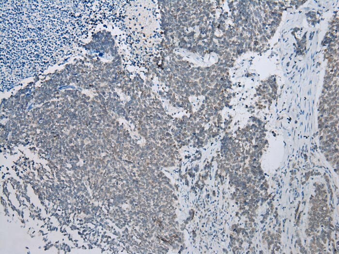 NAT15 Antibody in Immunohistochemistry (Paraffin) (IHC (P))