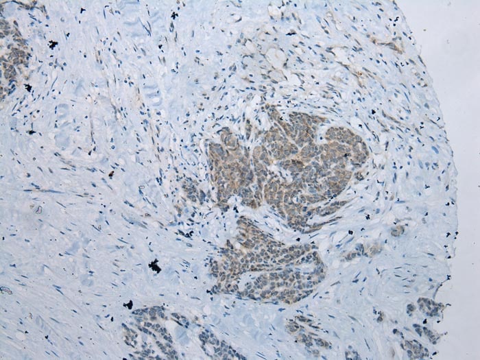 NAT15 Antibody in Immunohistochemistry (Paraffin) (IHC (P))