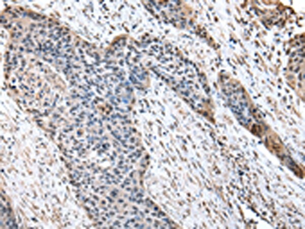 HPD Antibody in Immunohistochemistry (Paraffin) (IHC (P))