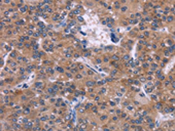 SKI Antibody in Immunohistochemistry (Paraffin) (IHC (P))
