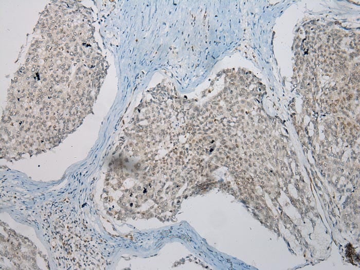 TUSC5 Antibody in Immunohistochemistry (Paraffin) (IHC (P))