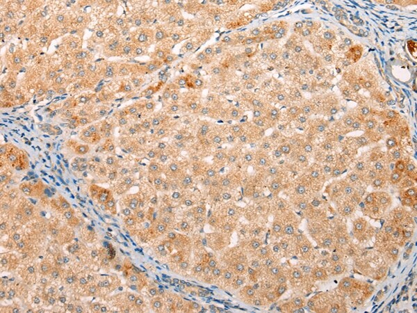 YRDC Antibody in Immunohistochemistry (Paraffin) (IHC (P))