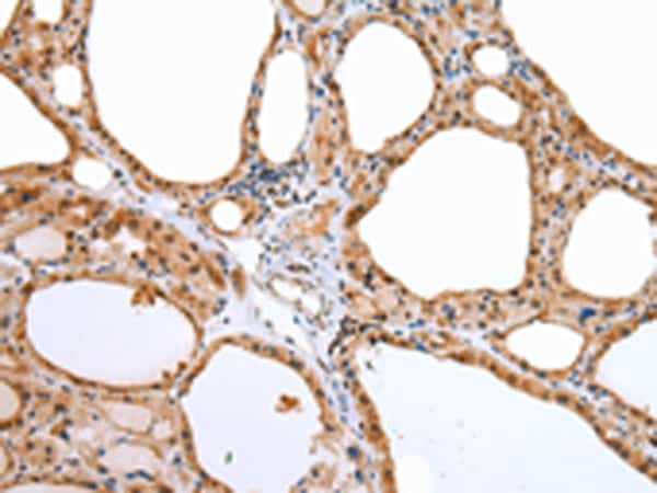 Aquaporin 9 Antibody in Immunohistochemistry (Paraffin) (IHC (P))