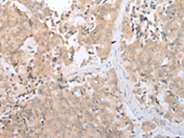 SLC2A6 Antibody in Immunohistochemistry (Paraffin) (IHC (P))