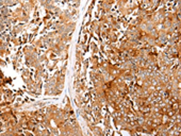 Glypican 1 Antibody in Immunohistochemistry (Paraffin) (IHC (P))