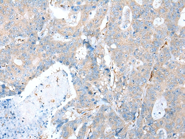 TRPV6 Antibody in Immunohistochemistry (Paraffin) (IHC (P))