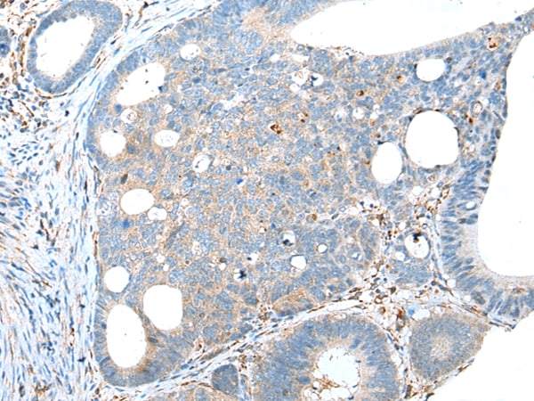 TRPV6 Antibody in Immunohistochemistry (Paraffin) (IHC (P))