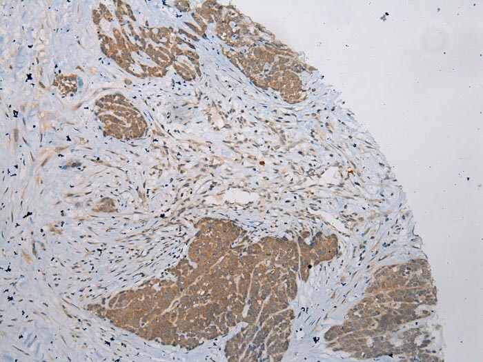 PLA2G12A Antibody in Immunohistochemistry (Paraffin) (IHC (P))