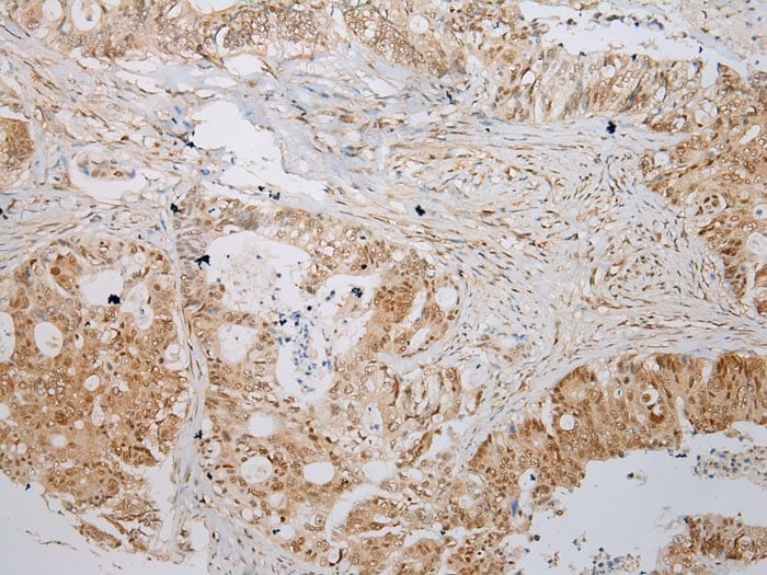 ABHEB Antibody in Immunohistochemistry (Paraffin) (IHC (P))