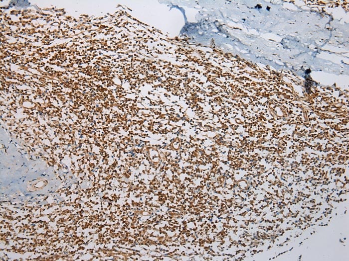 ABHEB Antibody in Immunohistochemistry (Paraffin) (IHC (P))