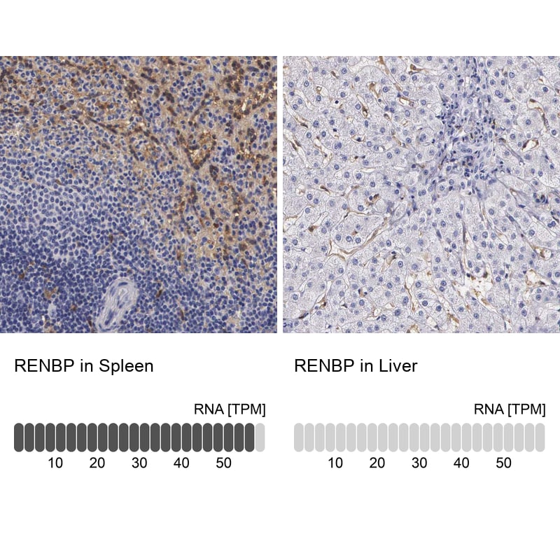 RENBP Antibody in Immunohistochemistry (IHC)