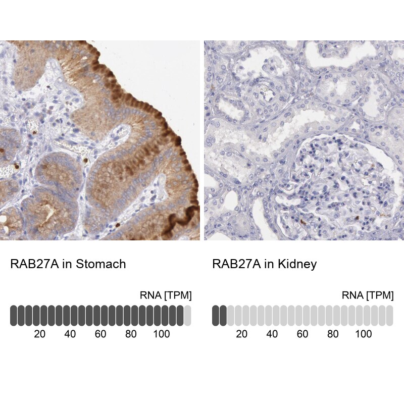 RAB27A Antibody in Immunohistochemistry (IHC)