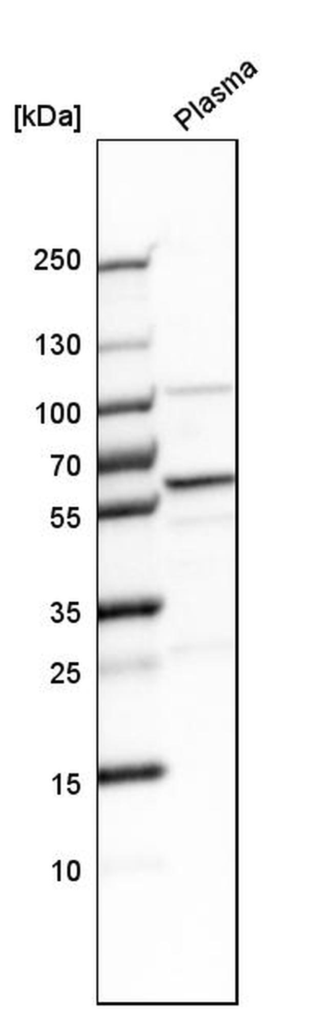 Complement Factor B Antibody (PA5-51640)