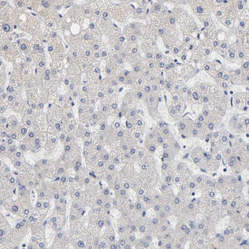 GRHL2 Antibody (PA5-52116)