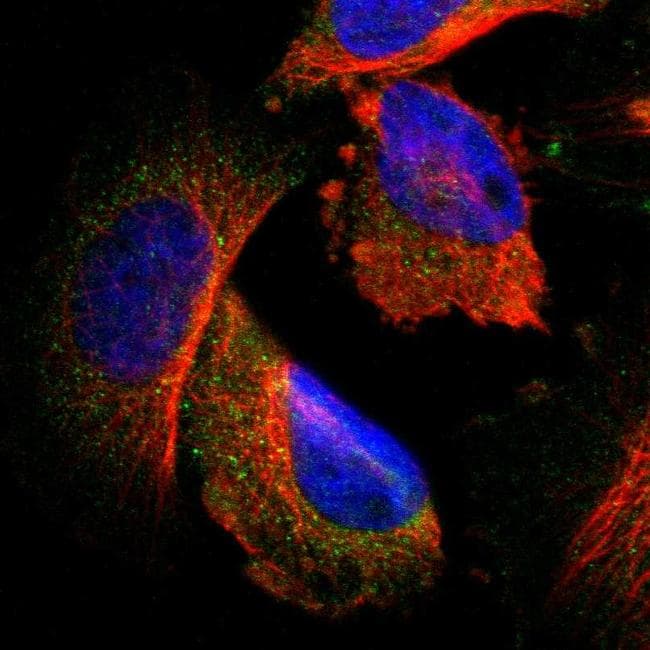 CLEC4E Antibody