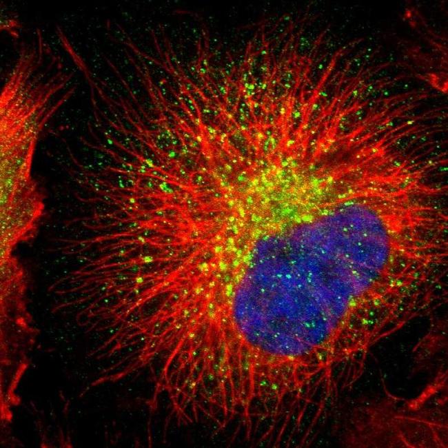 Anti-RAB7 Antibodies | Invitrogen