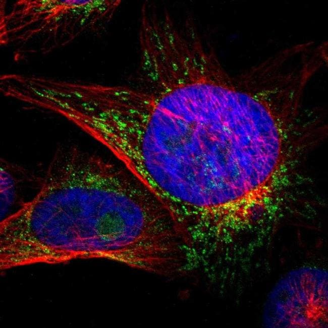 ACSL5 Antibody (PA5-52392)