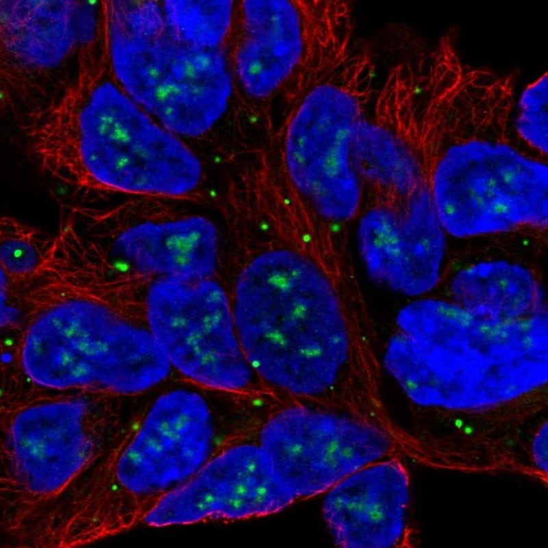 SLC6A15 Antibody (PA5-52586)