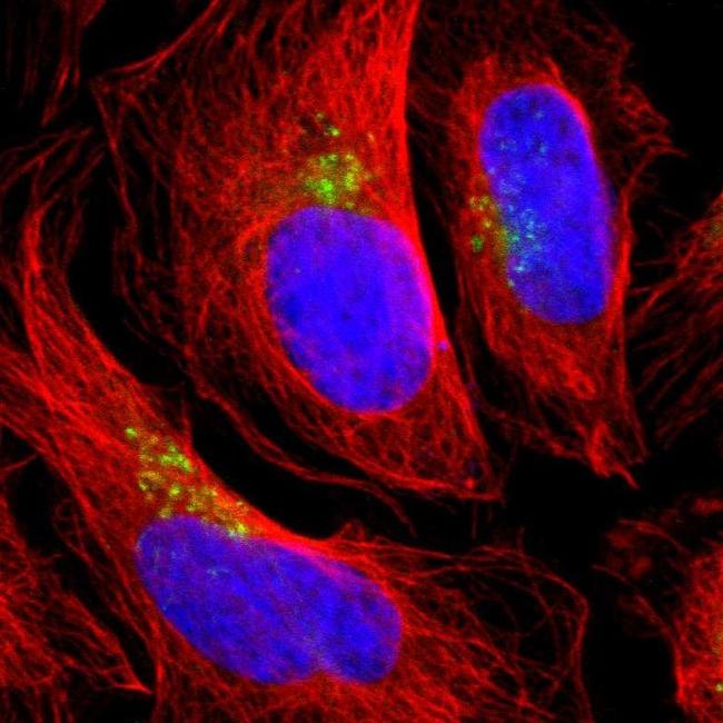 TMF1 Antibody (PA5-52598)