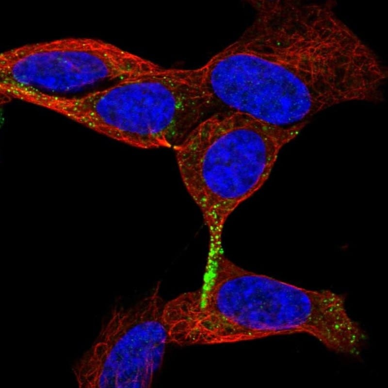 Chromogranin B Antibody (PA5-52605)