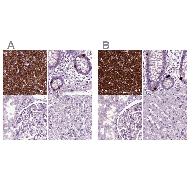 Chromogranin B Antibody (PA5-52605)