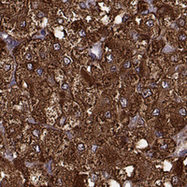 Chromogranin B Antibody