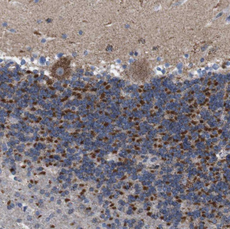 ZP2 Antibody (PA5-52815)