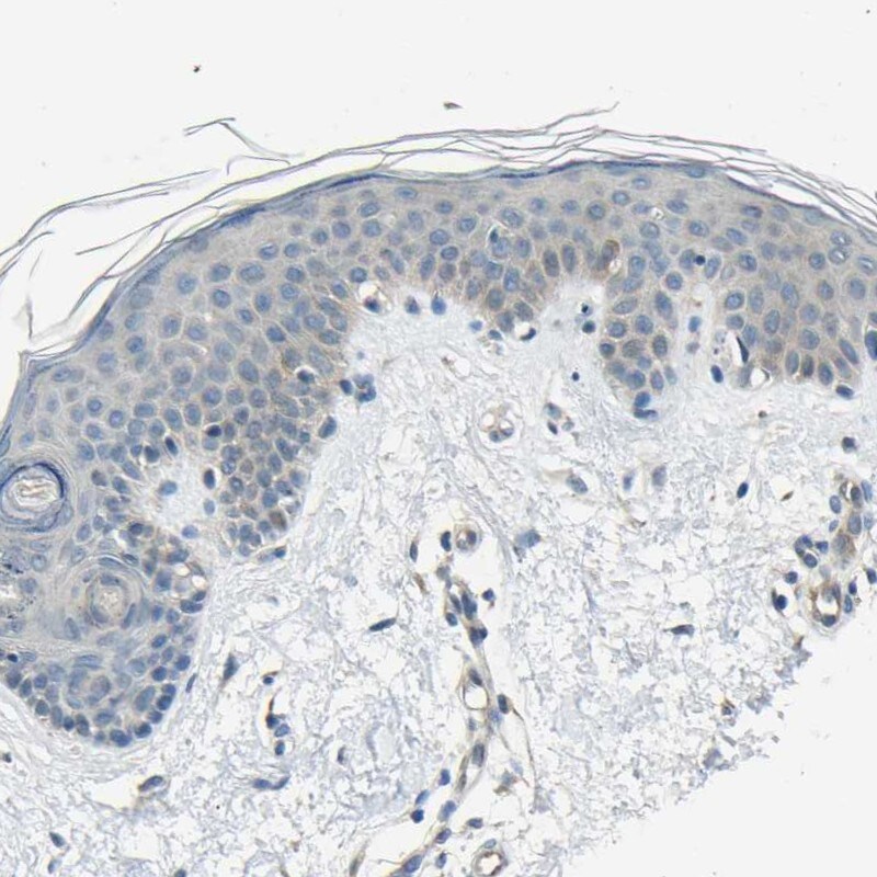 STBD1 Antibody (PA5-52884)