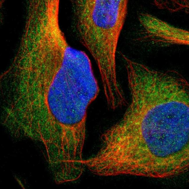 CYP26B1 Antibody (PA5-52948)