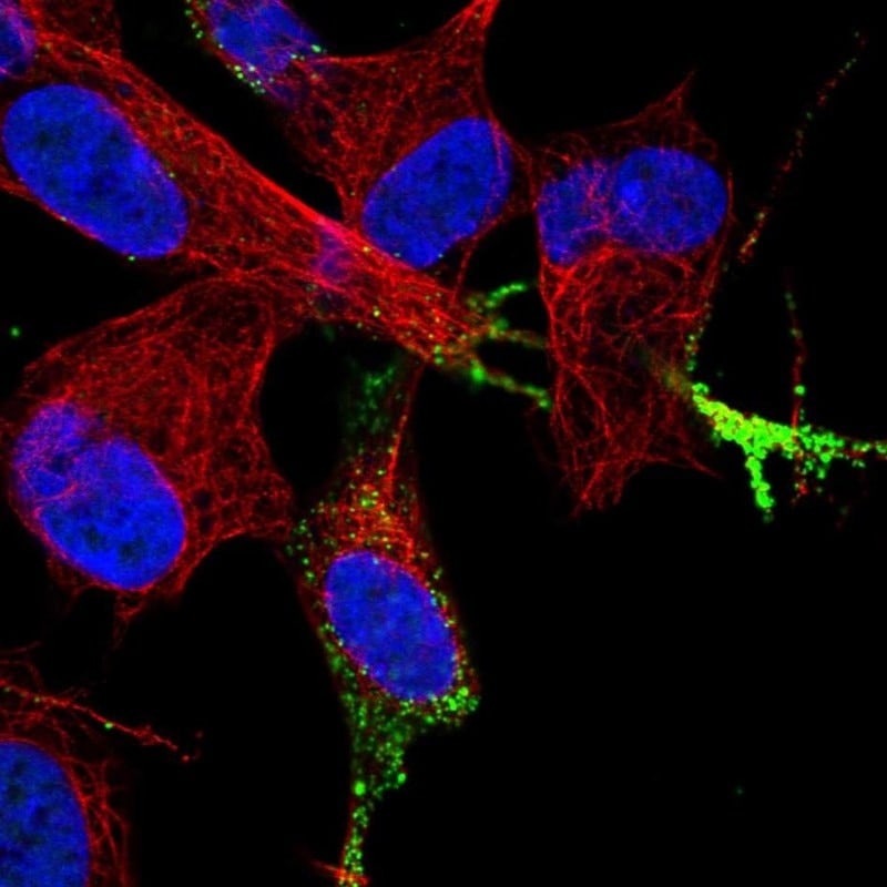 Chromogranin B Antibody (PA5-52954)